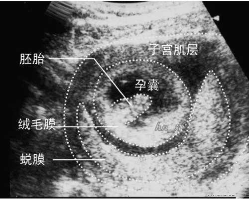 加拿大投资移民 利弊【加拿大曼省亲友担保移民申请流程】