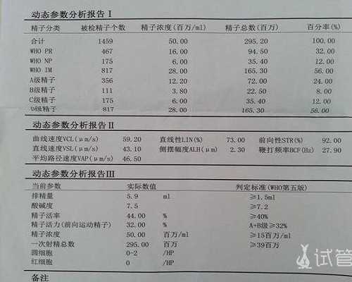投资移民 荷兰青岛（移民荷兰，到底为了什么？）