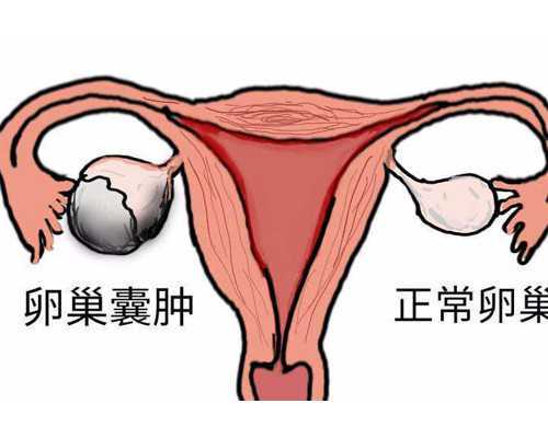美国2018年10月职业移民排期（美国买房不能移民，为什么房产仍然备受海外买家