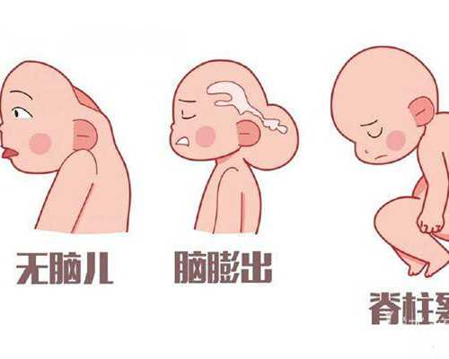 移民留学去美国（移民去美国的利弊分析）