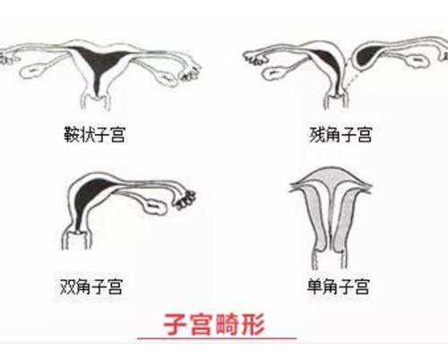 美国移民护照追踪（塞浦路斯护照免签美国，只知道这个优势亏大了！）