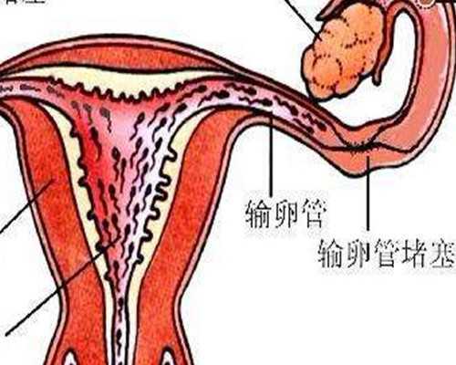 西班牙加拿大澳大利亚移民【加拿大需求大、工资高且好移民的职业有哪些？（