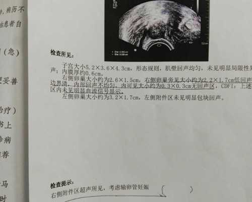 美国欧洲移民（详解：影响美国职业移民排期的因素有哪些？）