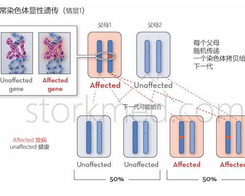 办移民去美国多少费用标准【美国洛杉矶人口破400万：华裔移民猛增】