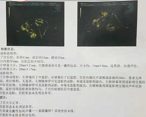 美国的华人和爱尔兰移民比较（掌握这些秘诀，祝你顺利拿到美国移民签证）