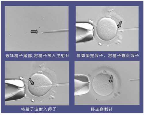 宁波 澳洲移民（澳洲移民政策解读：最适合澳洲技术移民的年轻一代）